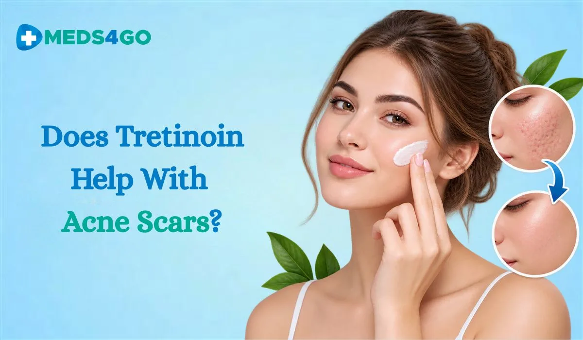 Does Tretinoin Help With Acne Scars?